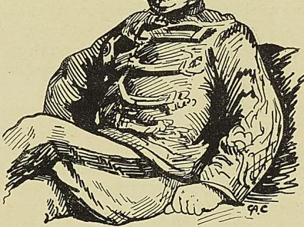 GÉNÉRAL BRÉART